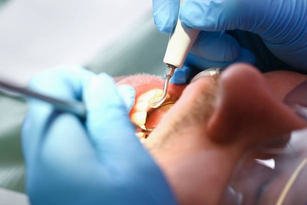 Best Broken or Chipped Tooth Repair in Hughesville, PA