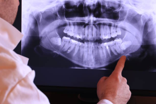 Best Dental Abscess Treatment in Hughesville, PA